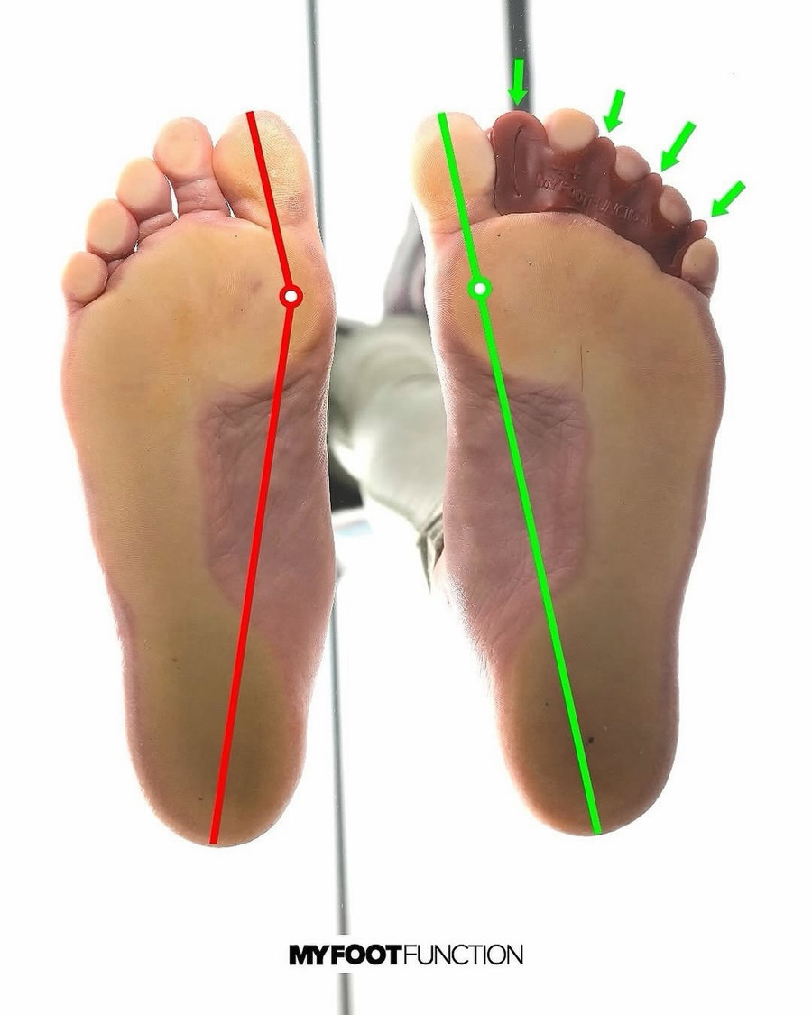 Compressed vs. splayed toes - stability comparison seen from underneath